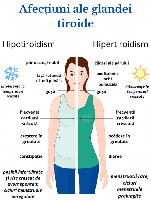 Importanța tiroidei și principalele afecțiuni ale acesteia. Scintigrafia tiroidiană